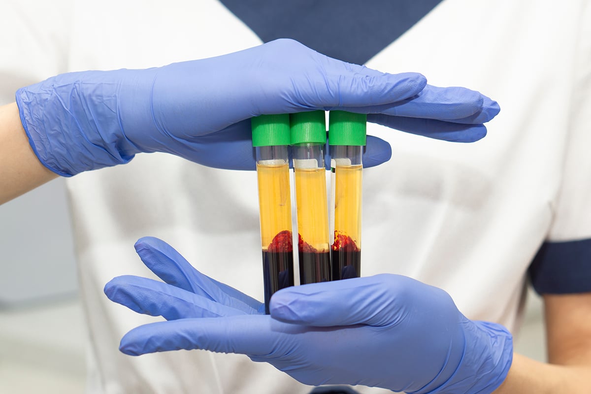 concert of laboratory blood tests and cosmetic injections for the beauty of skin and hair concert of laboratory blood tests and cosmetic injections for the beauty of skin and hair
