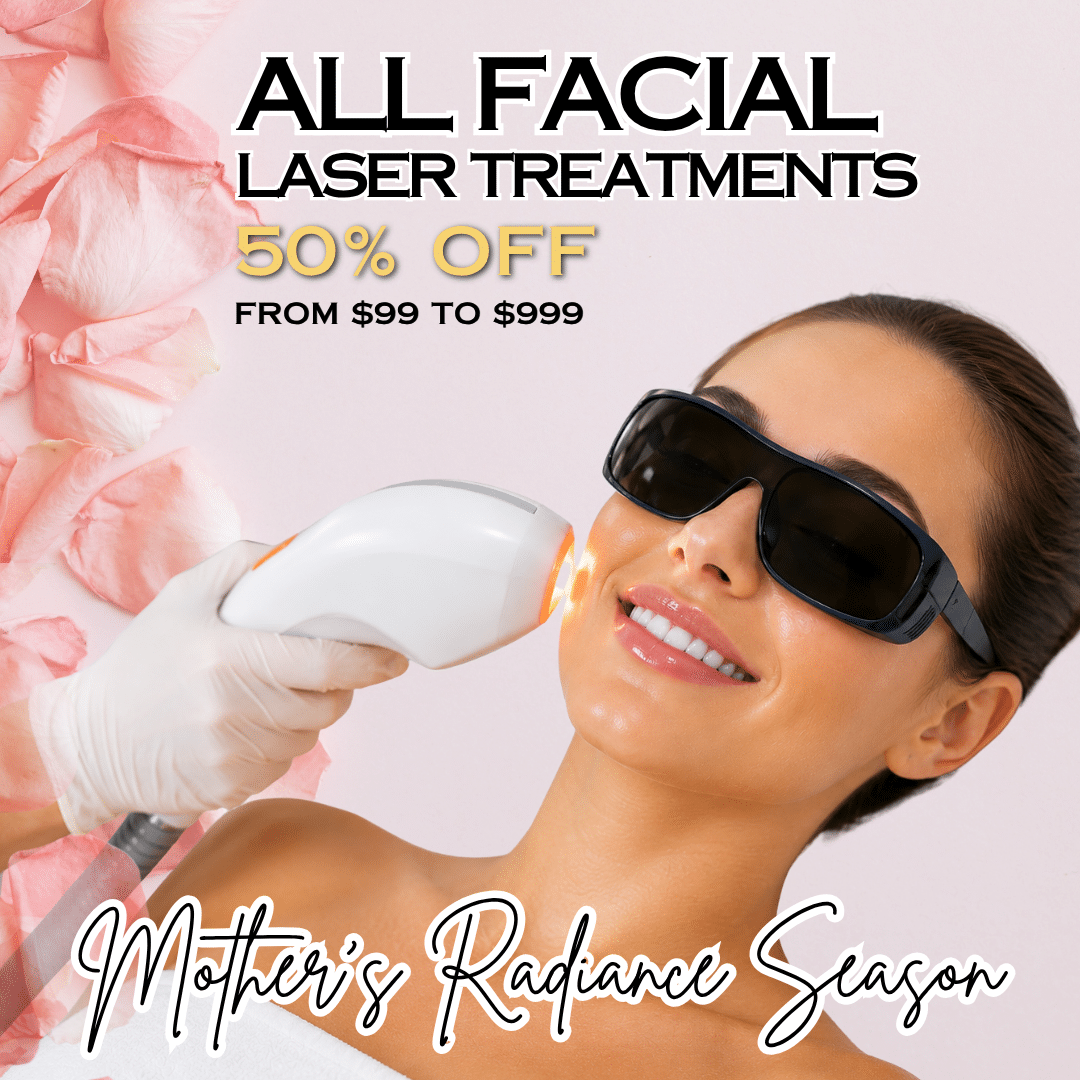 Facial Laser Treatment in Michigan Facial Laser Treatment in Michigan