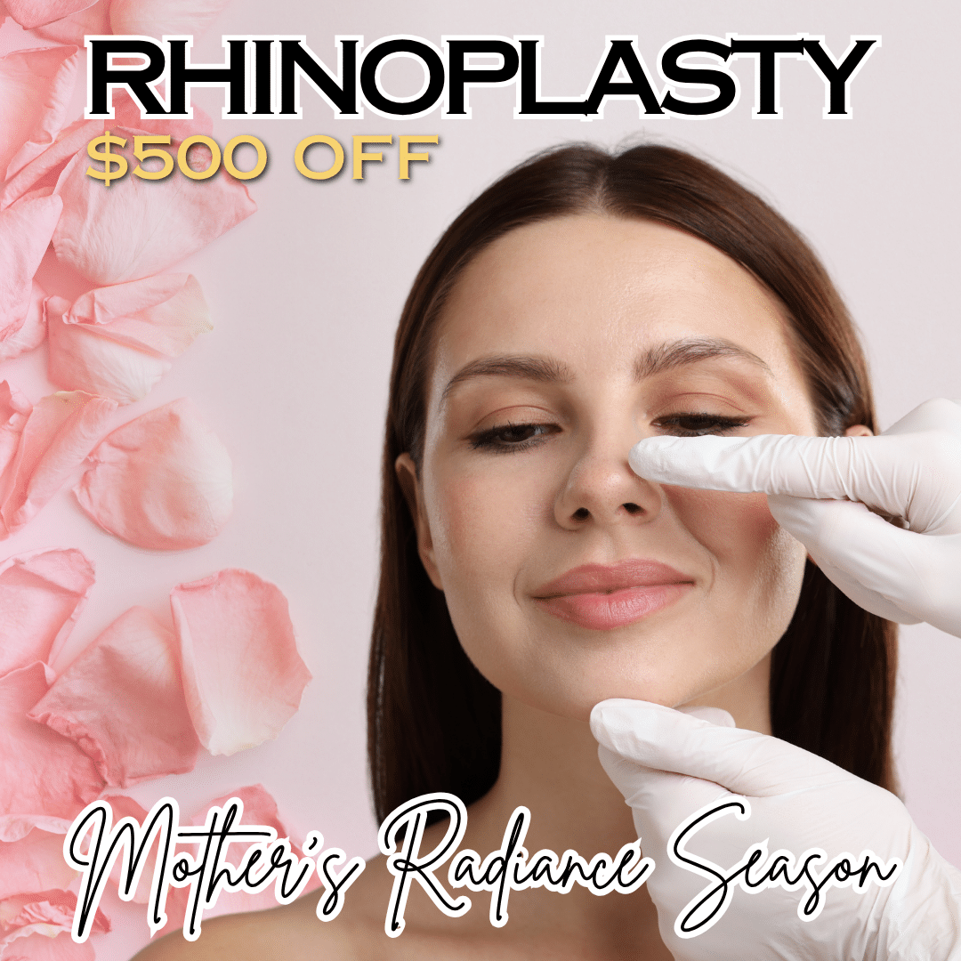 Rhinoplasty Rhinoplasty