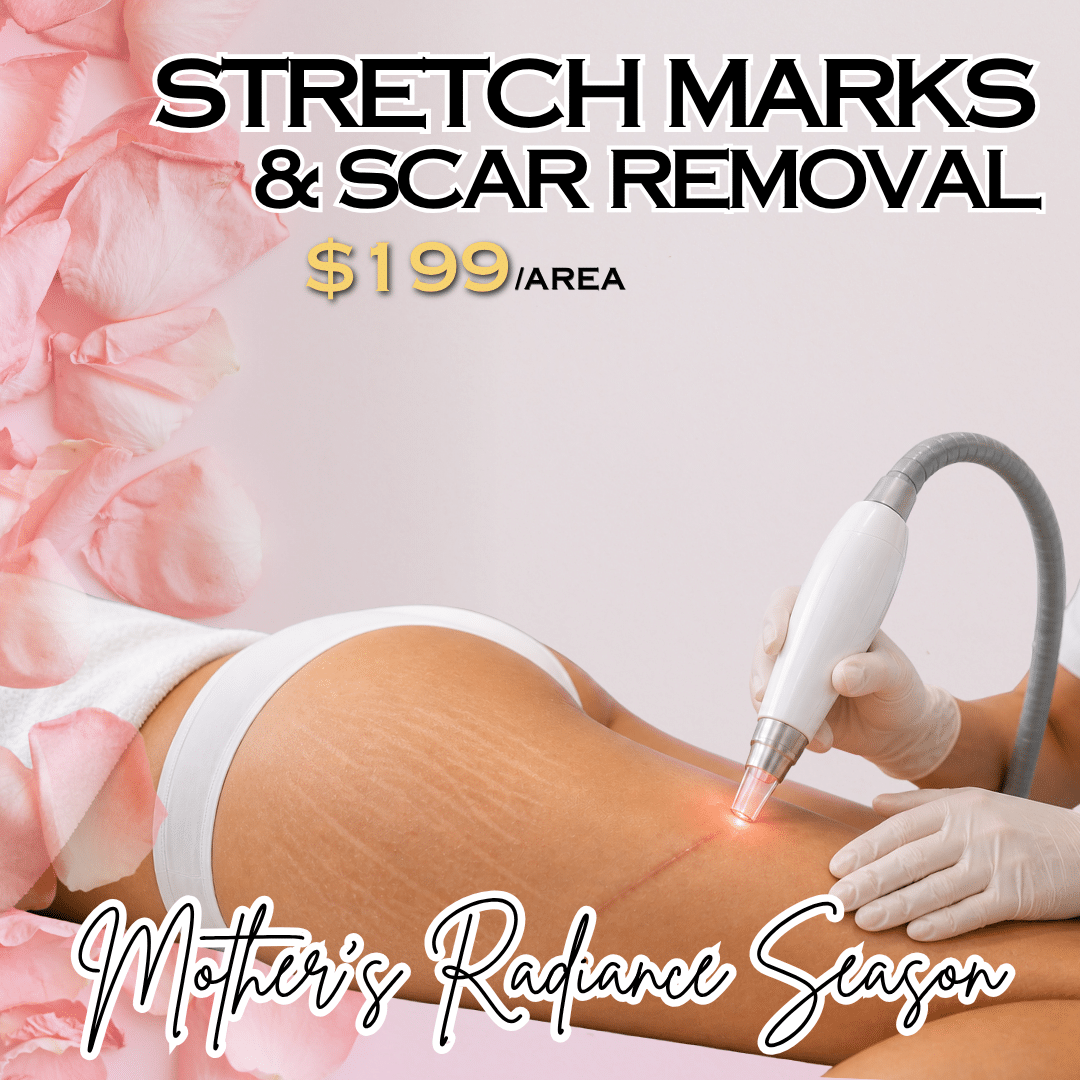 Scar Removal Scar Removal in Michigan