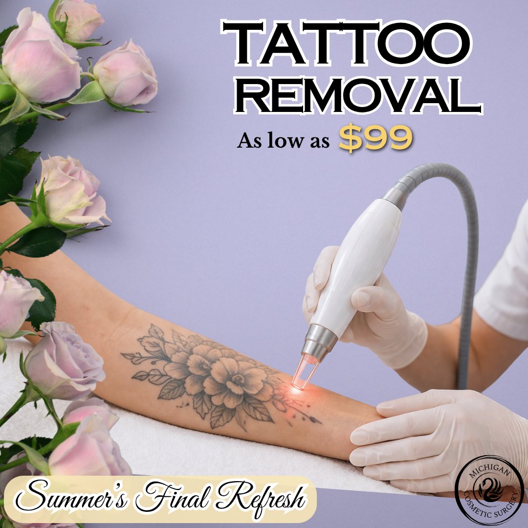 Tattoo Removal Tattoo Removal